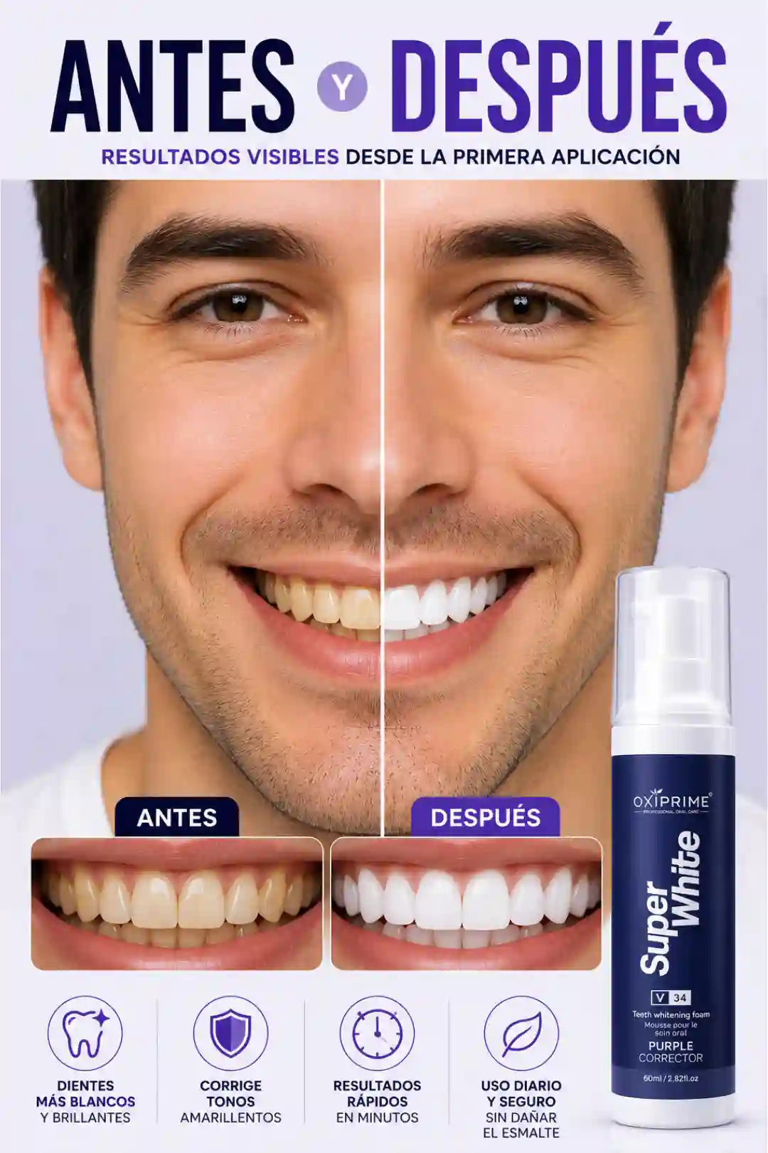 Blanqueador Dental Super White