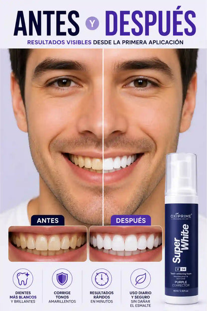 Blanqueador Dental Super White