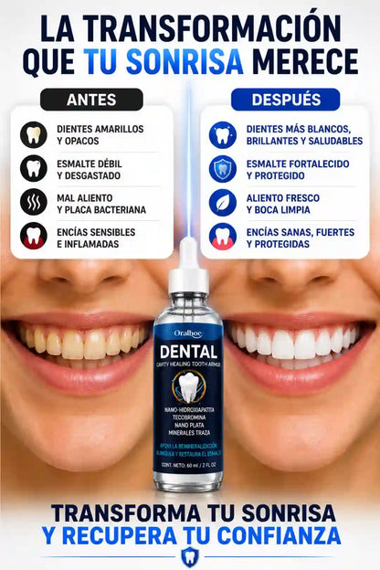 Solución Esmalte Dental